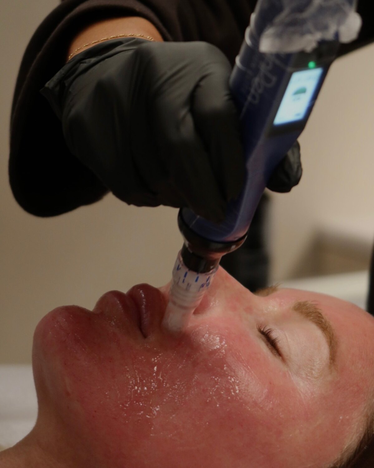 A skin treatment in progress at Alcove