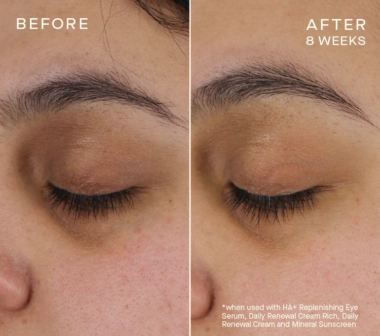 Advanced Regenerative Eye Serum