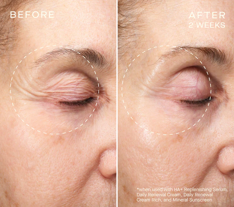 Advanced Regenerative Serum